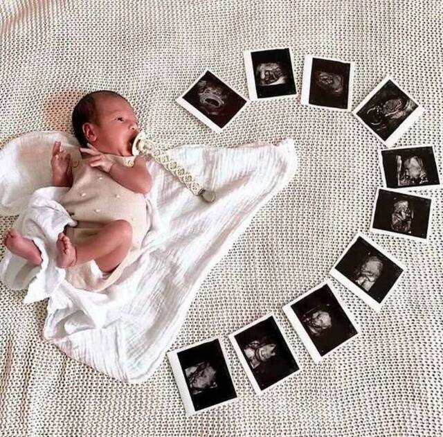 Ảnh em bé mới sinh theo thời điểm và mốc phát triển