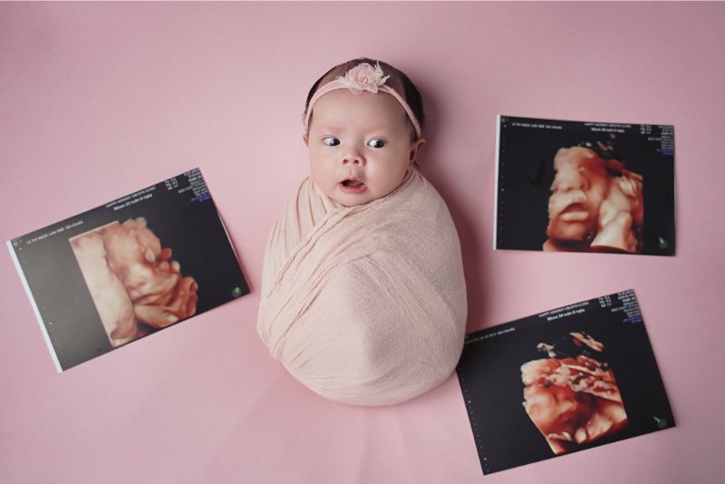 Lưu ý về sức khỏe và chăm sóc bé những ngày đầu