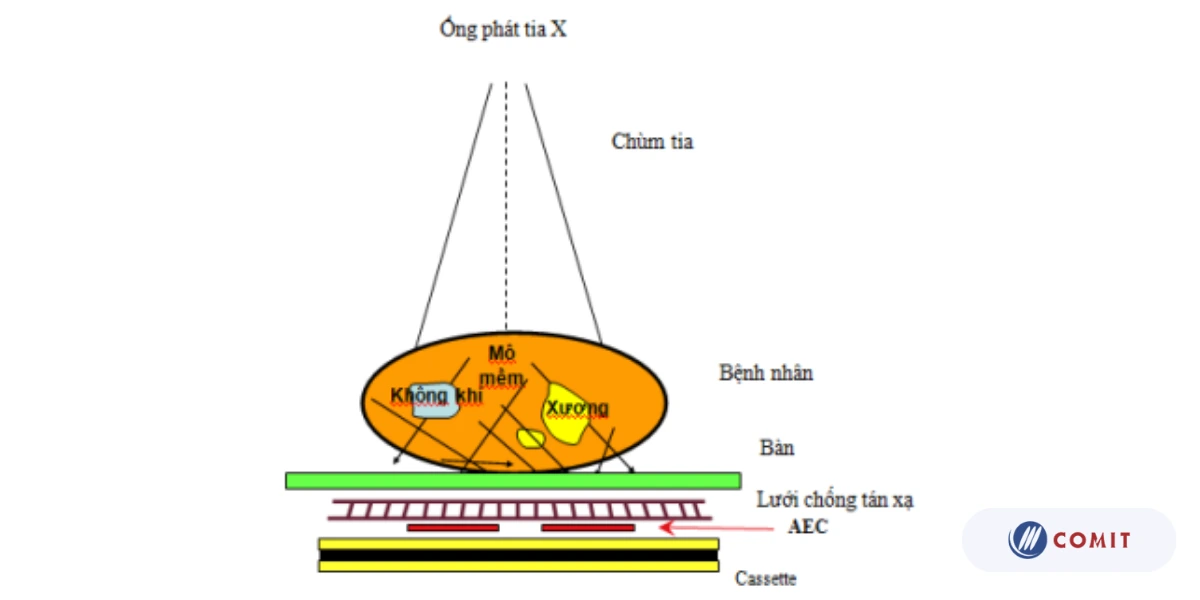 Các thành phần chính trong hệ chụp X-quang