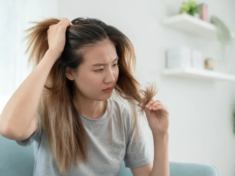Khái quát về rụng tóc