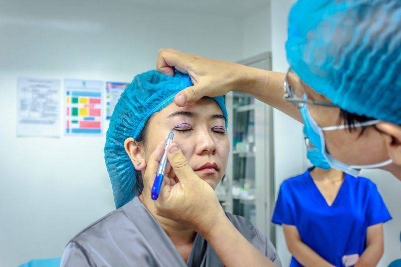 Kết quả cắt mí mắt tại Seoul Center