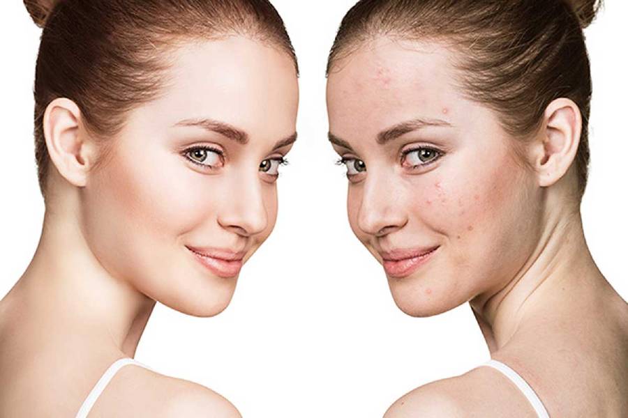 Lạm dụng kem phấn khi trang điểm cũng là nguyên nhân khiến da xấu đi, nhanh lão hóa
