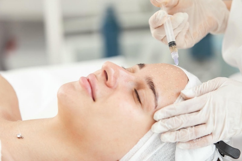 Bác sĩ tiến hành tiêm Fragmyx Oxyx vào da theo kỹ thuật meso