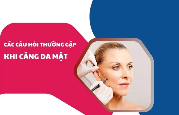 So sánh toàn diện các phương pháp căng da