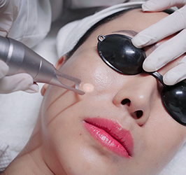 Trị Nám Sắc Tố Laser Matrix