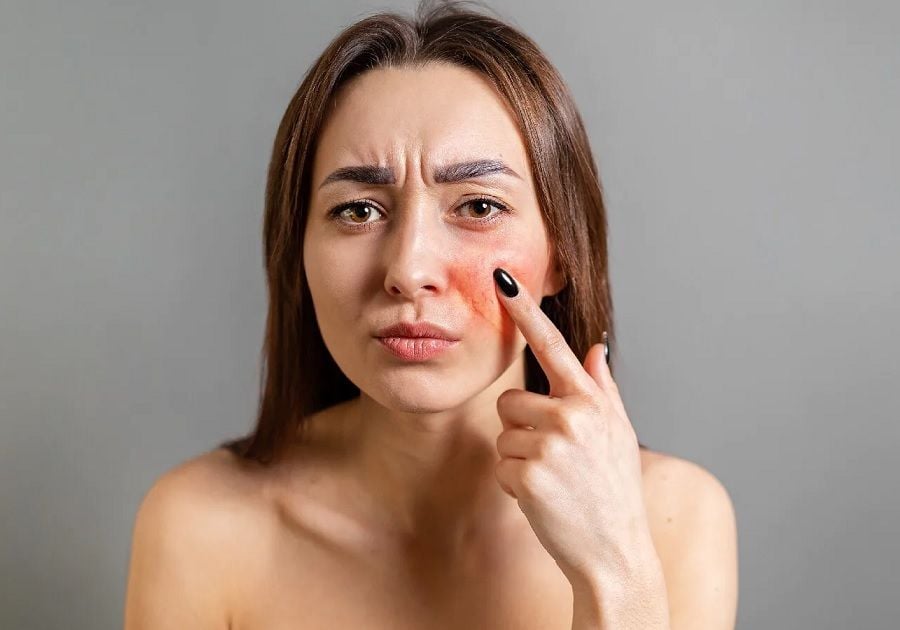 Những ai có làn da hư tổn, lão hóa, xuất hiện nếp nhăn, mất độ ẩm, lỗ chân lông to, da xỉn màu, kém sắc có thể tiêm Rejuran Healer để khắc phục