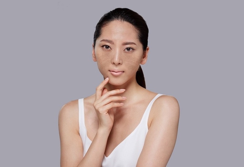 Những ai có làn da xỉn màu, lão hóa, kém sắc rất phù hợp tiêm trẻ hóa Neo Xcelens