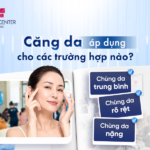 Căng da áp dụng cho các trường hợp nào_