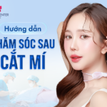 Hướng dẫn chăm sóc sau cắt mí