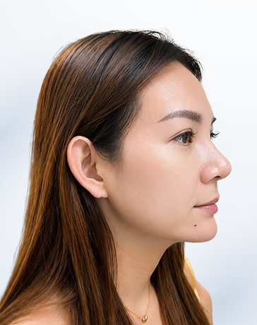 Mai An sau liệu trình
