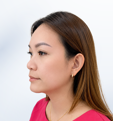 Khách hàng Mai An trước