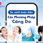 So sánh toàn diện các phương pháp căng da