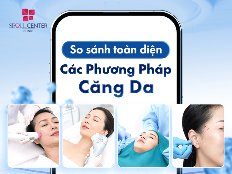 So sánh toàn diện các phương pháp căng da