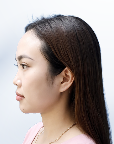 Kim Ngân trước liệu trình