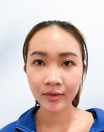 Như Ngân trước liệu trình