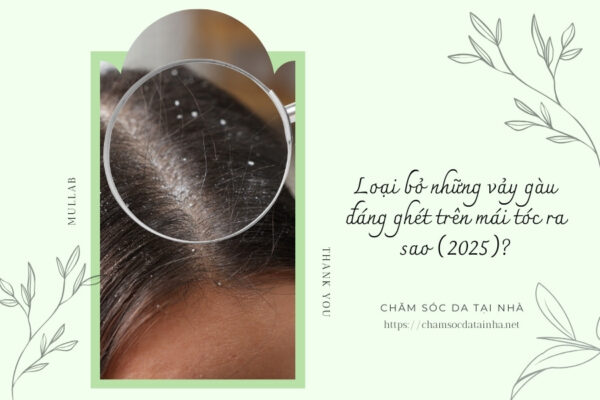 Loại bỏ những vảy gàu đáng ghét trên mái tóc ra sao (2025)
