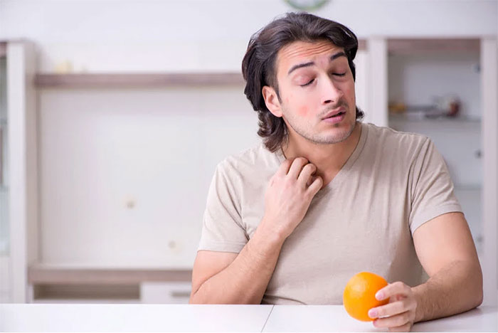 Các triệu chứng dị ứng cam quýt thường bắt đầu với dấu hiệu dị ứng miệng.