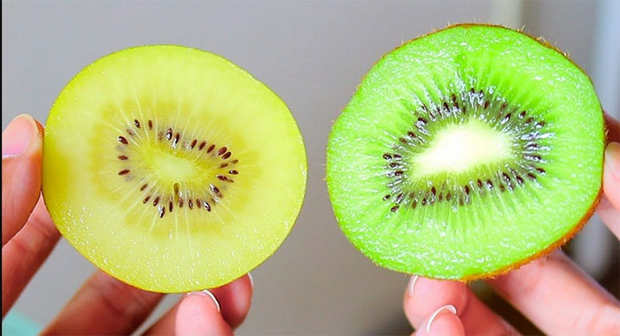 Nếu bạn có tiền sử sỏi thận, hãy tránh xa vỏ kiwi.