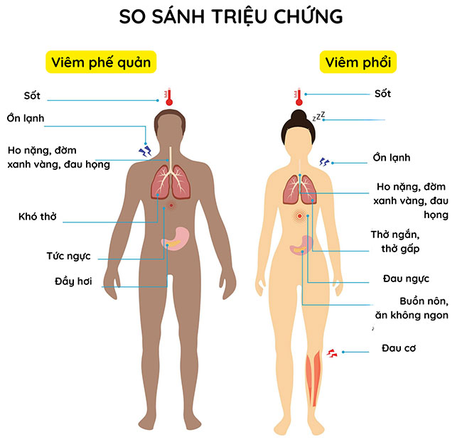 Phân biệt triệu chứng viêm phế quản và viêm phổi
