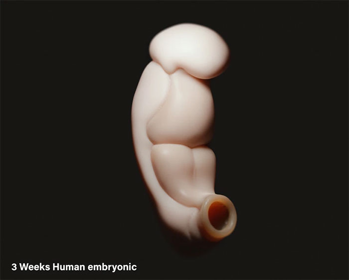 Hình ảnh 3D về phôi thai người khi được 3 tuần tuổi.