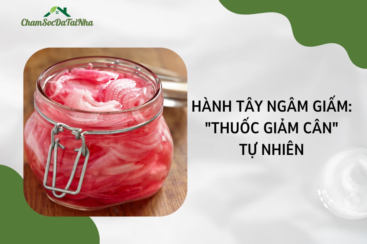 Hành tây ngâm giấm Thuốc giảm cân tự nhiên