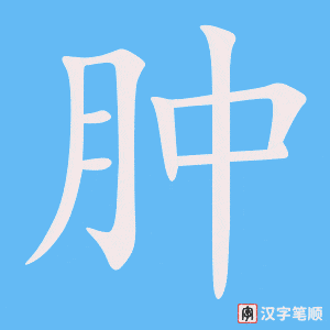 4892 - 肿瘤 - HSK6 - Từ điển tam ngữ 5099 từ vựng HSK 1-6 4892 - 肿瘤 - HSK6 - Từ điển tam ngữ 5099 từ vựng HSK 1-6