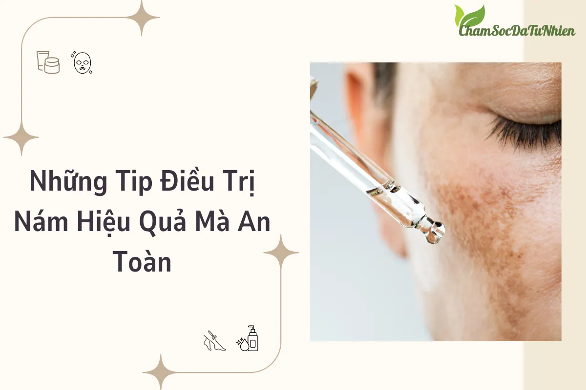 Những Tip Điều Trị Nám Hiệu Quả Mà An Toàn Những Tip Điều Trị Nám Hiệu Quả Mà An Toàn