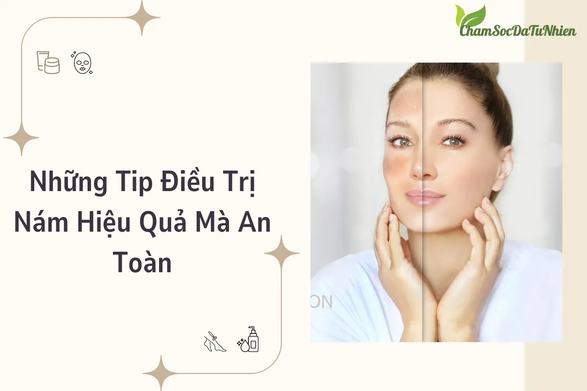 Những Tip Điều Trị Nám Hiệu Quả Mà An Toàn Những Tip Điều Trị Nám Hiệu Quả Mà An Toàn