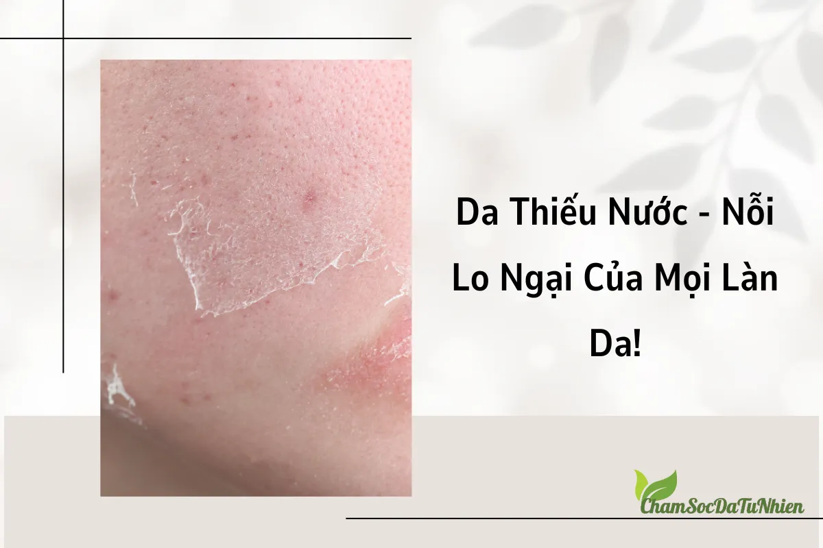 Da Thiếu Nước - Nỗi Lo Ngại Của Mọi Làn Da! Da Thiếu Nước - Nỗi Lo Ngại Của Mọi Làn Da!