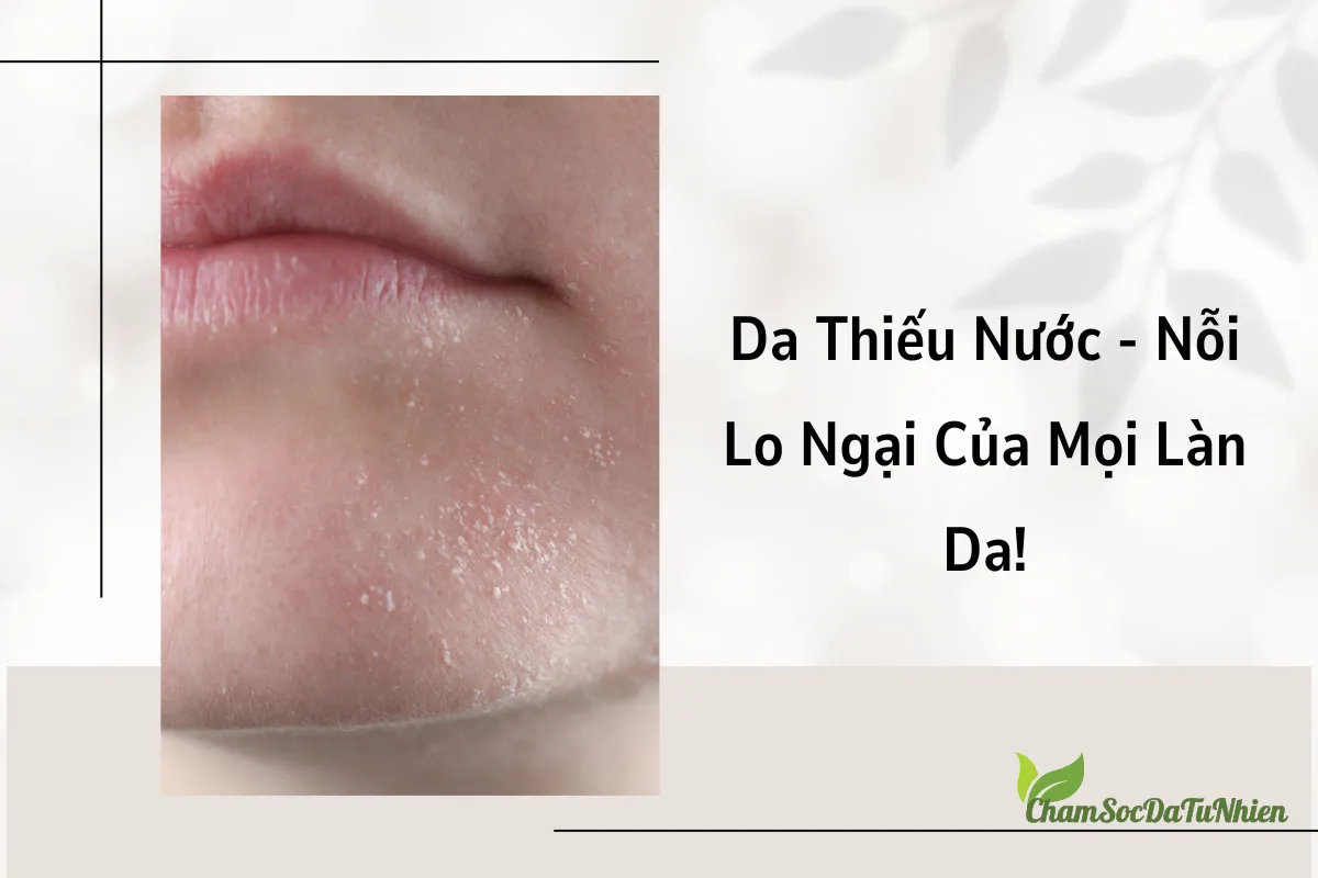 Da Thiếu Nước - Nỗi Lo Ngại Của Mọi Làn Da!