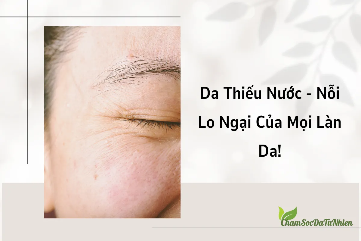 Da Thiếu Nước - Nỗi Lo Ngại Của Mọi Làn Da!
