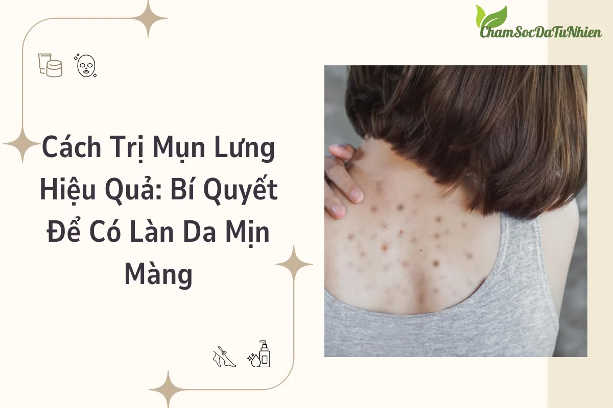 Cách Trị Mụn Lưng Hiệu Quả: Bí Quyết Để Có Làn Da Mịn Màng