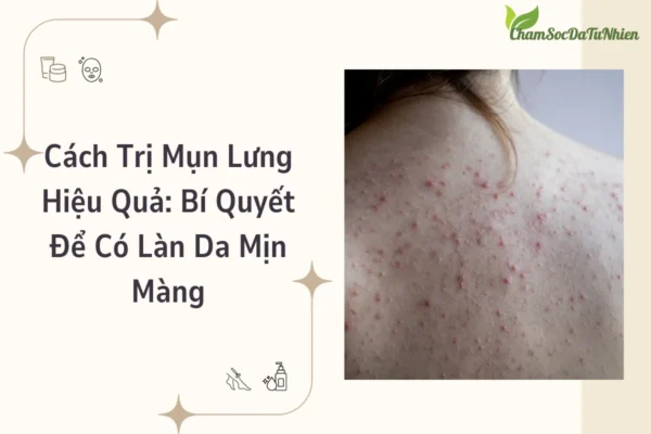Cách Trị Mụn Lưng Hiệu Quả: Bí Quyết Để Có Làn Da Mịn Màng