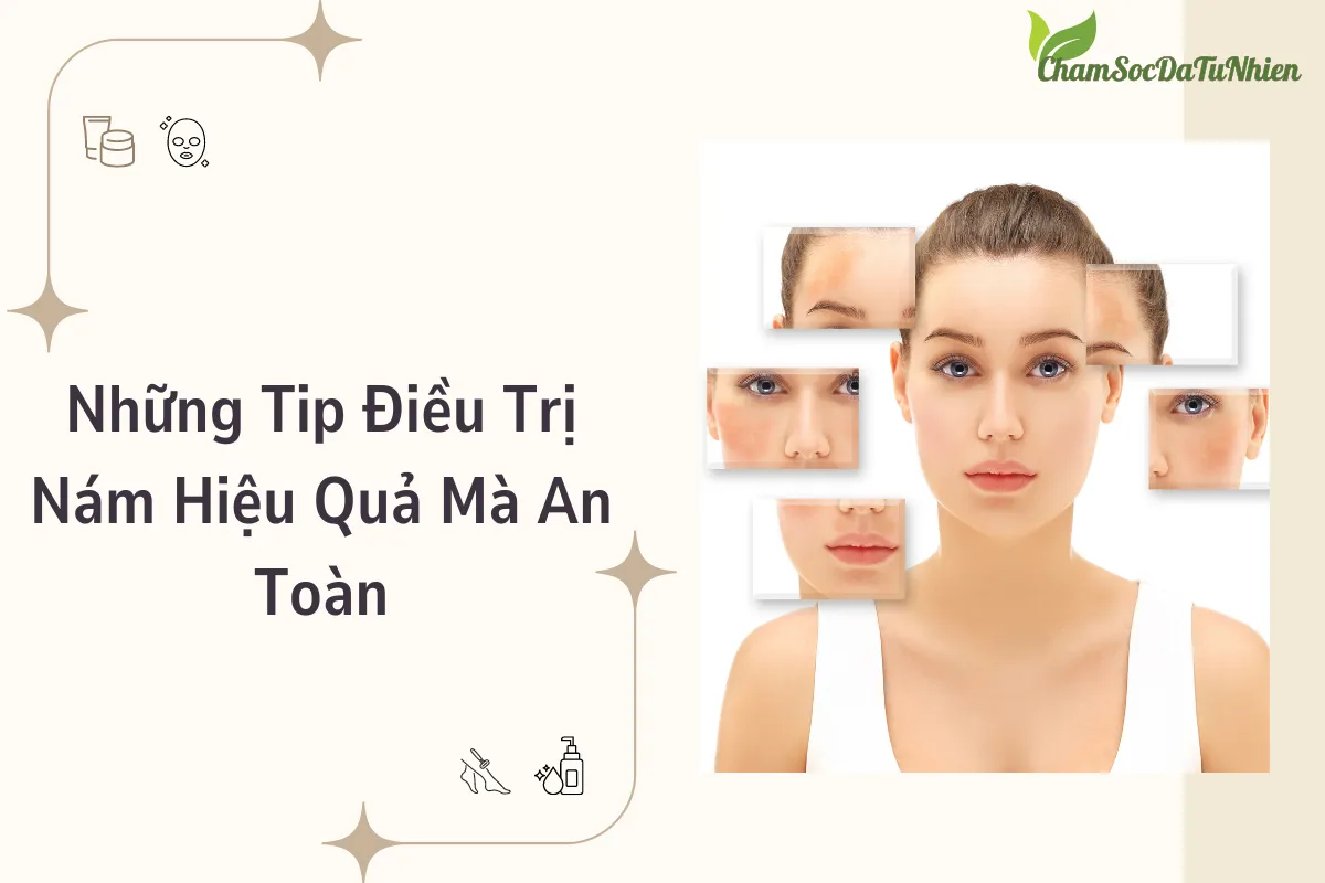 Những Tip Điều Trị Nám Hiệu Quả Mà An Toàn