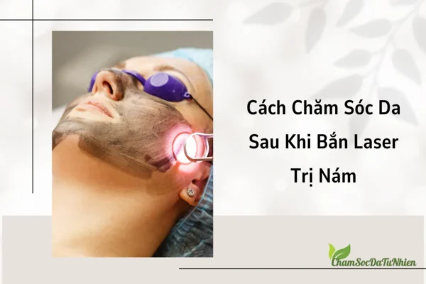 Cách Chăm Sóc Da Sau Khi Bắn Laser Trị Nám