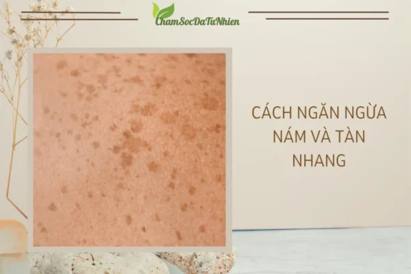 Cách Ngăn Ngừa Nám Và Tàn Nhang