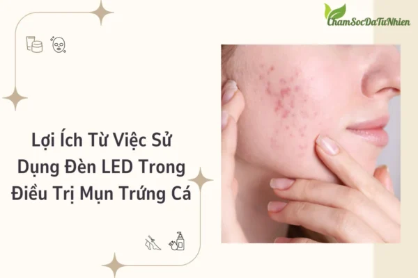 Lợi Ích Từ Việc Sử Dụng Đèn LED Trong Điều Trị Mụn Trứng Cá