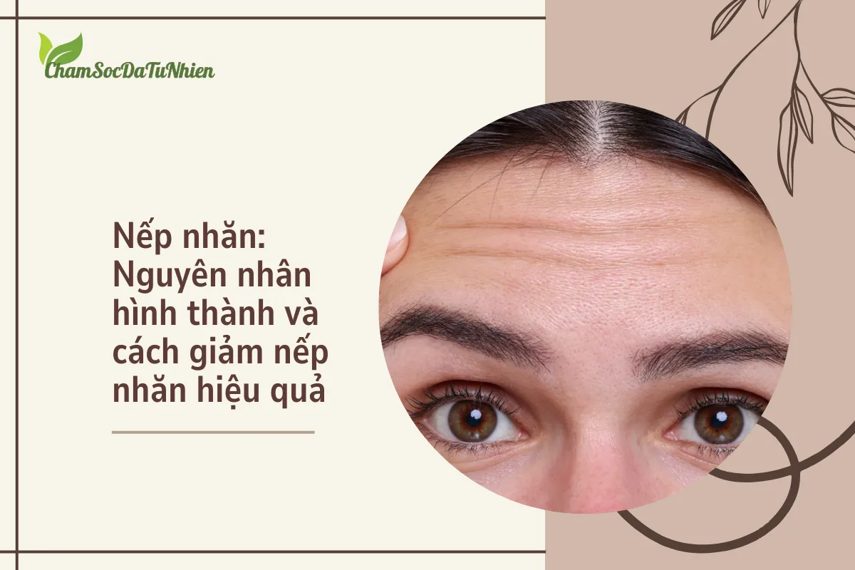 Nếp nhăn Nguyên nhân hình thành và cách giảm nếp nhăn hiệu quả (1) Nếp nhăn Nguyên nhân hình thành và cách giảm nếp nhăn hiệu quả (1)