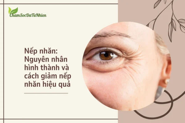 Nếp nhăn Nguyên nhân hình thành và cách giảm nếp nhăn hiệu quả