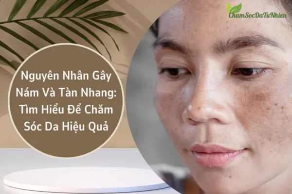 Nguyên Nhân Gây Nám Và Tàn Nhang Tìm Hiểu Để Chăm Sóc Da Hiệu Quả