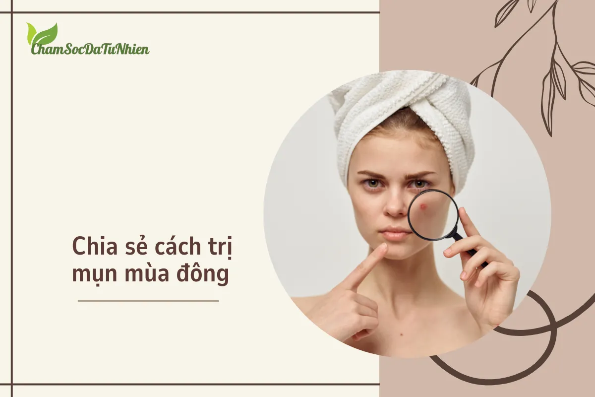 Chia sẻ cách trị mụn mùa đông (1)
