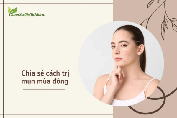 Chia sẻ cách trị mụn mùa đông