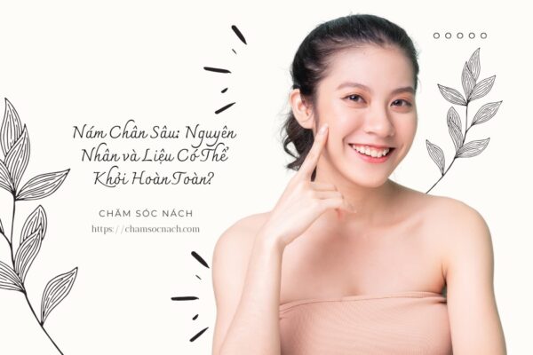 Nám Chân Sâu Nguyên Nhân và Liệu Có Thể Khỏi Hoàn Toàn