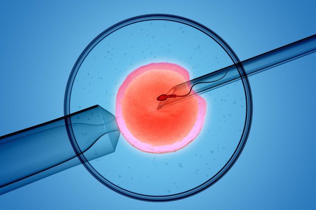 Thụ tinh ống nghiệm giúp hỗ trợ sinh sản cho các cặp vợ chồng vô sinh hiếm muộn