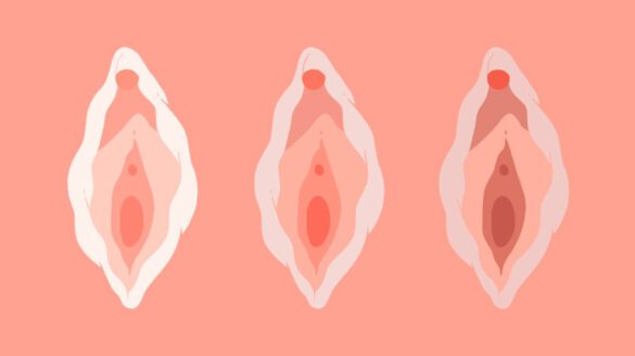 Những thay đổi về cấu trúc tử cung gây ra hiện tượng chảy máu âm đạo bất thường