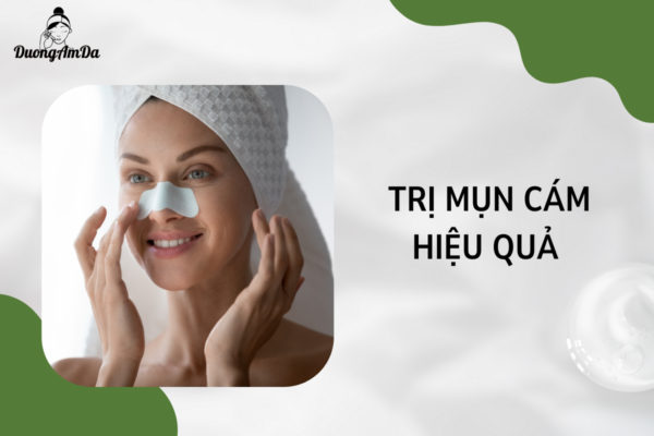 Cách trị mụn cám hiệu quả mà bạn không nên bỏ qua