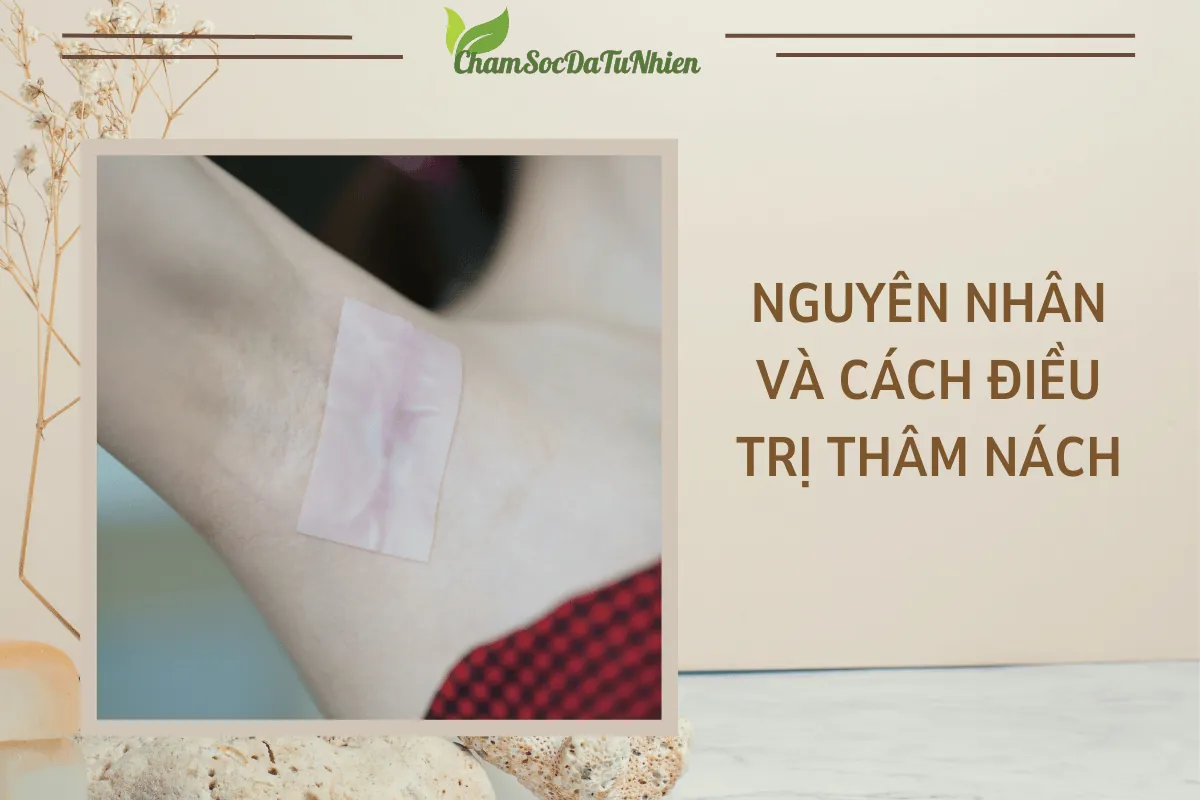 Chọn lăn khử mùi như thế nào cho đúng (5)