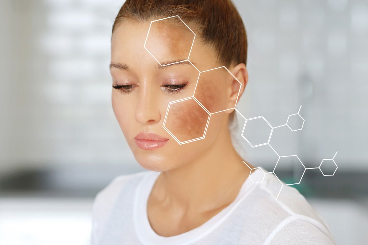 Sắc Tố Melanin Là Gì (3) Sắc Tố Melanin Là Gì (3)