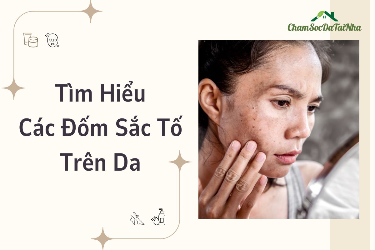 Tìm Hiểu Các Đốm Sắc Tố Trên Da (1)