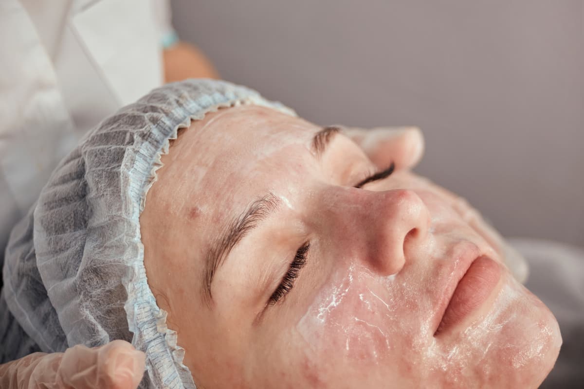 Bí kíp chăm sóc da sau nặn mụn Ngăn ngừa thâm và phục hồi da (3) Bí kíp chăm sóc da sau nặn mụn Ngăn ngừa thâm và phục hồi da (3)